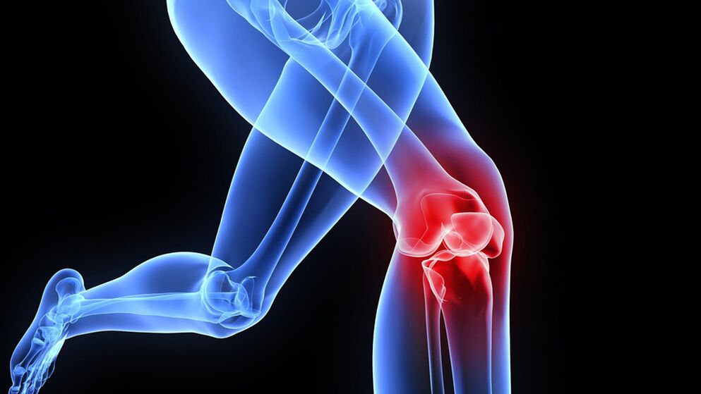 проблеми с коленете поради артроза